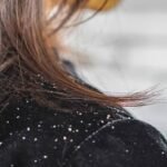 Mengatasi Ketombe, Cara Merawat Kulit Kepala agar Rambut Kembali Nyaman
